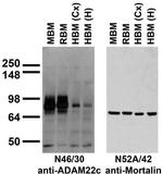 ADAM22 (Cytoplasmic) Antibody in Western Blot (WB)