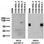 NGL-3/LRRC4B Monoclonal Antibody (N51/6)