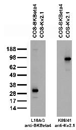BKbeta4 K+ Channel Antibody in Western Blot (WB)