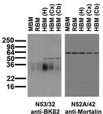 BKbeta2 K+ Channel Antibody in Western Blot (WB)
