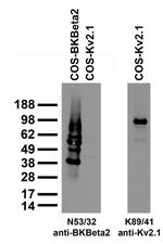 BKbeta2 K+ Channel Antibody in Western Blot (WB)