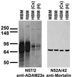 ADAM22 (Extracellular) Antibody in Western Blot (WB)