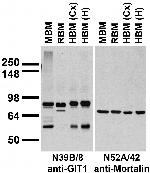 GIT1 Antibody in Western Blot (WB)