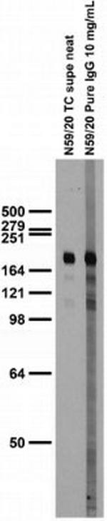 GluN2B/NR2B Glutamate Receptor Antibody in Western Blot (WB)
