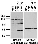GluN2B/NR2B Glutamate Receptor Antibody in Western Blot (WB)