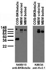 BKbeta3a K+ Channel Antibody in Western Blot (WB)