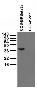 BKbeta3a K+ Channel Antibody in Western Blot (WB)