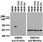 Zinedin Antibody in Western Blot (WB)