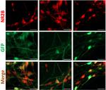 GluN2B/NR2B Glutamate Receptor Monoclonal Antibody (N59/36)