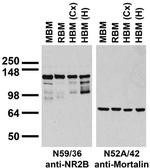 GluN2B/NR2B Glutamate Receptor Antibody in Western Blot (WB)