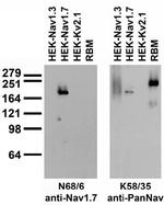 Nav1.7 Na+ Channel Antibody in Western Blot (WB)