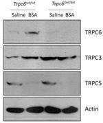 TrpC5 Antibody in Western Blot (WB)