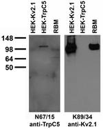 TrpC5 Antibody in Western Blot (WB)