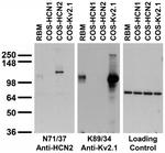 HCN2 Antibody in Western Blot (WB)