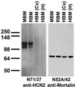 HCN2 Antibody in Western Blot (WB)