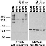 mGluR1/5 (Group I) Glutamate Receptor Antibody in Western Blot (WB)