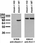 Ataxin-1/11NQ Antibody in Western Blot (WB)