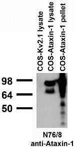 Ataxin-1/11NQ Antibody in Western Blot (WB)