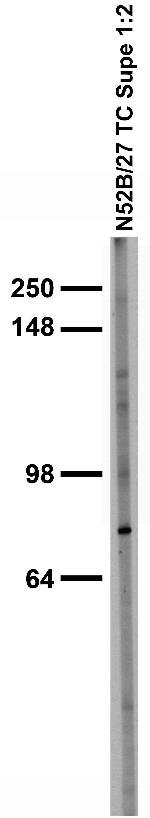 SALM2/LRFN1 Antibody in Western Blot (WB)