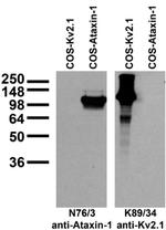 Ataxin-1/11NQ Antibody in Western Blot (WB)