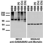 GABA-B-R2 Antibody in Western Blot (WB)