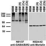 GABA-B-R2 Antibody in Western Blot (WB)