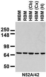 Mortalin/GRP75 Antibody in Western Blot (WB)