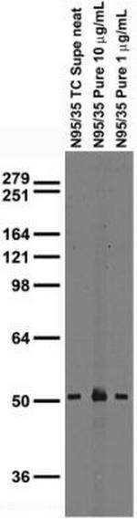 GABA-A-R/Alpha1 Antibody in Western Blot (WB)