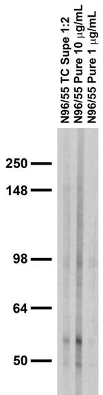 GABA-A-R/Beta1 Antibody in Western Blot (WB)