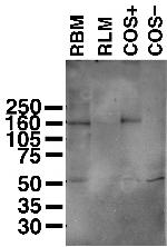 Copper ATPase 2 (Wilson's Disease Protein) Antibody in Western Blot (WB)