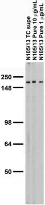 Ankyrin-B Antibody in Western Blot (WB)