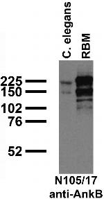 Ankyrin-B Antibody in Western Blot (WB)