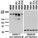 Ankyrin-B Antibody in Western Blot (WB)