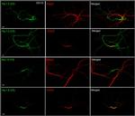 Ankyrin-G Antibody in Immunocytochemistry (ICC/IF)