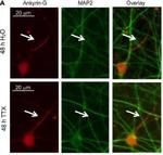 Ankyrin-G Antibody in Immunocytochemistry (ICC/IF)