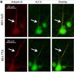 Ankyrin-G Monoclonal Antibody (N106/36)