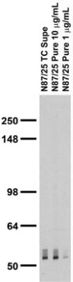 GABA-A-R/Beta3 Antibody in Western Blot (WB)