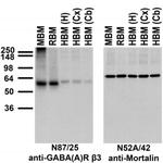 GABA-A-R/Beta3 Antibody in Western Blot (WB)