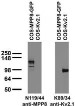 MPP8 Antibody in Western Blot (WB)