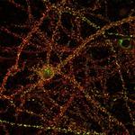 Pan-SAPAP Antibody in Immunocytochemistry (ICC/IF)