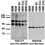 Pan-SAPAP Antibody in Western Blot (WB)