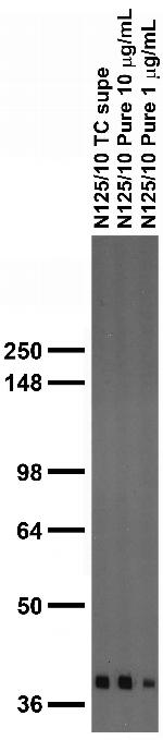 Thorase/Atad1 Antibody in Western Blot (WB)