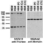 Thorase/Atad1 Antibody in Western Blot (WB)