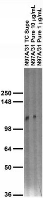 Neuroligin-1 Antibody in Western Blot (WB)
