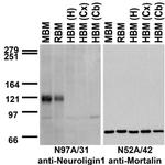 Neuroligin-1 Antibody in Western Blot (WB)
