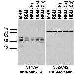 Pan-QKI Antibody in Western Blot (WB)