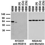 RGS14 Antibody in Western Blot (WB)