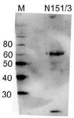GABA-A-R/Delta Antibody in Western Blot (WB)