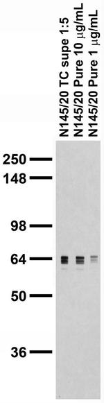 Pan-GRK Antibody in Western Blot (WB)