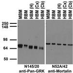 Pan-GRK Antibody in Western Blot (WB)